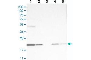 Western blot analysis of Lane 1: RT-4, Lane 2: U-251 MG, Lane 3: Human Plasma, Lane 4: Liver, Lane 5: Tonsil with TMEM199 polyclonal antibody . (TMEM199 antibody)