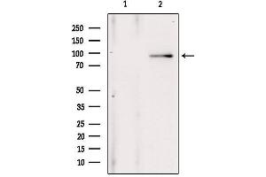 Western blot analysis of extracts from 293, using ANO1 Antibody.