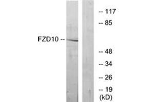Western blot analysis of extracts from COS7 cells, using FZD10 Antibody. (FZD10 antibody  (AA 135-184))