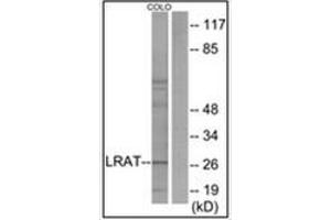 Western blot analysis of extracts from COLO205 cells, using LRAT Antibody . (LRAT antibody  (Internal Region))