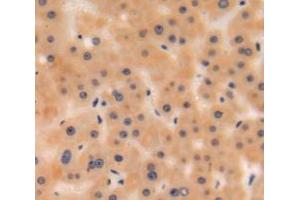 #VALUE! (C3 antibody  (AA 965-1303))