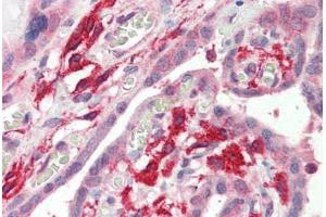 Human Placenta (formalin-fixed, paraffin-embedded) stained with AIF1 antibody ABIN337130 at 2. (Iba1 antibody  (AA 138-148))