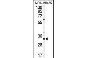 Western blot analysis of SGF29 Antibody (C-term) (ABIN651333 and ABIN2840193) in MDA-M cell line lysates (35 μg/lane).