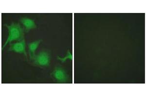 Immunofluorescence analysis of HuvEc cells, using NFE2L2 antibody (ABIN5976469). (NRF2 antibody  (C-Term))