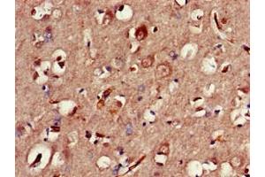 Immunohistochemistry of paraffin-embedded human brain tissue using ABIN7147793 at dilution of 1:100 (CLOCK antibody  (AA 577-846))
