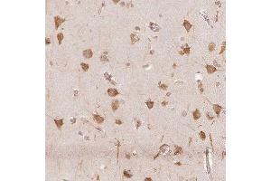 Immunohistochemical staining of human cerebral cortex with RCN3 polyclonal antibody  shows strong cytoplasmic positivity in neuronal cells at 1:2500-1:5000 dilution. (RCN3 antibody)