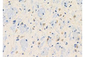 ABIN6260194 and ABIN6272676 at 1/100 staining Mouse brain tissue by IHC-P. (BAI3 antibody  (Internal Region))