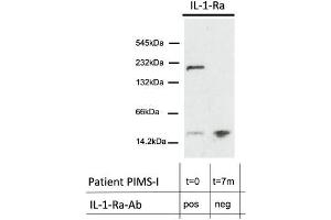 WB of IL-1-Ra of total plasma protein in a native, gradient gel under non-reducing conditions of patient MIS-C-I at presentation with acute inflammation and seropositive for IL-1-Ra-Abs of IgG class and 7 months later without IL-1-Ra-Abs. (IL1RN antibody)