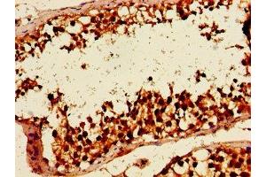 Immunohistochemistry of paraffin-embedded human testis tissue using ABIN7154943 at dilution of 1:100 (HLTF antibody  (AA 332-476))