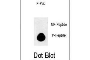 Dot Blot (DB) image for anti-APG8b (pThr93), (pTyr99) antibody (ABIN3001933) (APG8b (pThr93), (pTyr99) antibody)