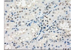 Immunohistochemical staining of paraffin-embedded Kidney tissue using anti-GBP2mouse monoclonal antibody. (GBP2 antibody)