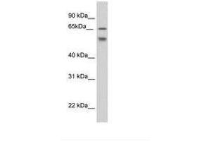 Image no. 1 for anti-Epithelial Splicing Regulatory Protein 2 (ESRP2) (AA 61-110) antibody (ABIN202881) (ESRP2 antibody  (AA 61-110))