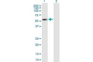 Western Blot analysis of S100PBP expression in transfected 293T cell line by S100PBP MaxPab polyclonal antibody. (S100PBP antibody  (AA 1-408))