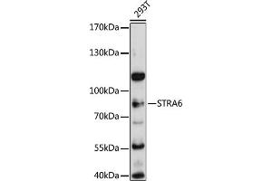 Western blot analysis of extracts of 293T cells, using STR antibody (ABIN6133187, ABIN6148633, ABIN6148634 and ABIN6215704) at 1:3000 dilution.