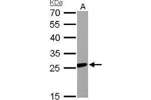 WB Image RGS2 antibody detects RGS2 protein by Western blot analysis.