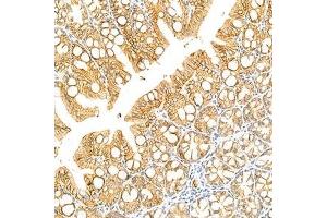 Immunohistochemistry analysis of paraffin-embedded mouse colon using LI Cadherin (ABIN7074493) at dilution of 1: 1500 (LI Cadherin antibody)