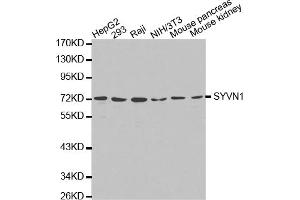 Western blot analysis of extracts of various cell lines, using SYVN1 antibody (ABIN5971424). (SYVN1 antibody)