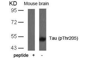Western blot analysis of extracts from mouse brain tissue using Tau(Phospho-Thr205) Antibody and the same antibody preincubated with blocking peptide. (MAPT antibody  (pThr205))