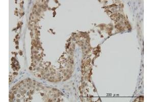 Image no. 3 for anti-Heat Shock 70kDa Protein 1-Like (HSPA1L) (AA 561-642) antibody (ABIN598752) (HSPA1L antibody  (AA 561-642))