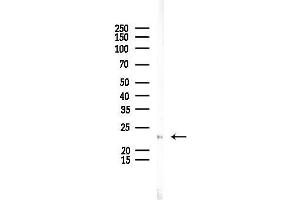 anti-PYD and CARD Domain Containing (PYCARD) (N-Term) antibody