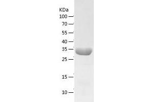 Western Blotting (WB) image for Ornithine Carbamoyltransferase (OTC) (AA 33-354) protein (His tag) (ABIN7124271) (OTC Protein (AA 33-354) (His tag))