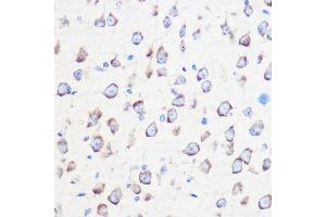 Immunohistochemistry of paraffin-embedded mouse brain using C Rabbit pAb (ABIN7266028) at dilution of 1:100 (40x lens). (Calmodulin 3 antibody  (AA 1-100))