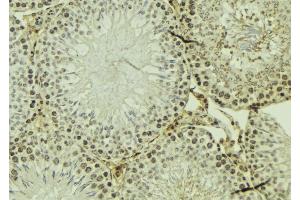 ABIN6274119 at 1/100 staining Mouse testis tissue by IHC-P. (TRIM3 antibody  (Internal Region))