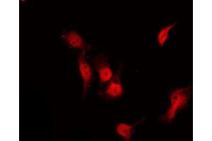 ABIN6267233 staining NIH-3T3 by IF/ICC. (HDAC3 antibody  (pSer424))