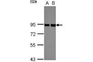 WB Image Sample (30 ug of whole cell lysate) A: A549 B: HeLa 7. (PRKCSH antibody)