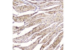 IHC analysis of Cardiac FABP using anti-Cardiac FABP antibody (ABIN5693024).
