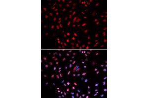 Immunofluorescence (IF) image for anti-Polymerase (DNA Directed), delta 1, Catalytic Subunit 125kDa (POLD1) antibody (ABIN1876511)