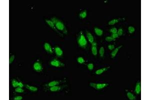 Immunofluorescent analysis of Hela cells using ABIN7155327 at dilution of 1:100 and Alexa Fluor 488-congugated AffiniPure Goat Anti-Rabbit IgG(H+L) (HDAC8 antibody  (AA 1-377))