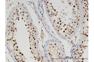 Immunoperoxidase of monoclonal antibody to TTRAP on formalin-fixed paraffin-embedded human testis. (TDP2 antibody  (AA 1-362))