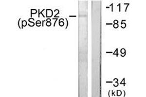 Western blot analysis of extracts from NIH-3T3 cells treated with PMA 250ng/ml 15', using PKD2 (Phospho-Ser876) Antibody. (PKD2 antibody  (pSer876))