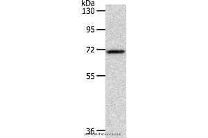 Western blot analysis of Mouse liver tissue, using SOX13 Polyclonal Antibody at dilution of 1:800 (SOX13 antibody)