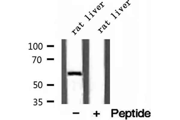 D2HGDH antibody  (C-Term)