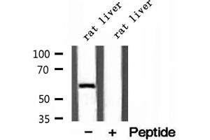 Western blot analysis of extracts of rat liver tissue, using D2HGDH antibody. (D2HGDH antibody  (C-Term))