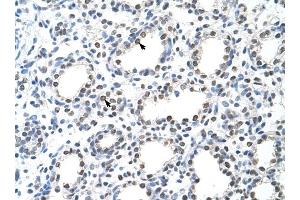 THOC1 antibody was used for immunohistochemistry at a concentration of 4-8 ug/ml to stain Alveolar cells (arrows) in Human Lung. (THOC1 antibody  (C-Term))