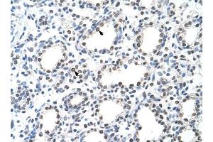 THOC1 antibody was used for immunohistochemistry at a concentration of 4-8 ug/ml to stain Alveolar cells (arrows) in Human Lung.