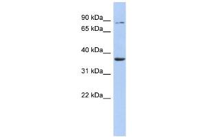 WB Suggested Anti-HS3ST1 Antibody Titration:  0. (HS3ST1 antibody  (Middle Region))