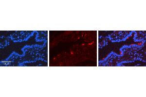 Rabbit Anti-SCGB1A1 Antibody   Formalin Fixed Paraffin Embedded Tissue: Human Lung Tissue Observed Staining: Cytoplasm, Plasma membrane Primary Antibody Concentration: 1:600 Other Working Concentrations: N/A Secondary Antibody: Donkey anti-Rabbit-Cy3 Secondary Antibody Concentration: 1:200 Magnification: 20X Exposure Time: 0. (SCGB1A1 antibody  (Middle Region))