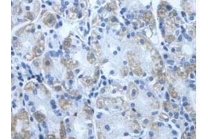 DAB staining on IHC-P; Samples: Human Stomach Tissue (DLD antibody  (AA 280-487))
