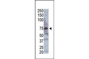 Image no. 1 for anti-Acyl-CoA Synthetase Long-Chain Family Member 4 (ACSL4) (AA 244-274) antibody (ABIN357780) (ACSL4 antibody  (AA 244-274))