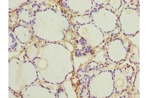 Immunohistochemistry of paraffin-embedded human thyroid tissue using ABIN7161614 at dilution of 1:100 (NINJ2 antibody  (AA 17-81))