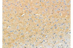 ABIN6261368 and ABIN6273232 at 1/100 staining Rat brain tissue by IHC-P.