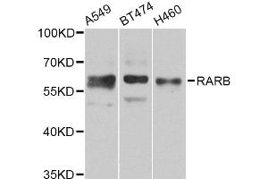 Western blot analysis of extracts of various cell lines, using RARB Antibody (ABIN5975866) at 1/1000 dilution.