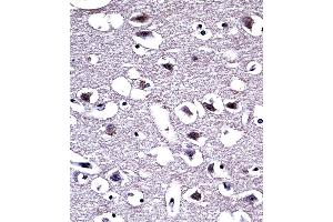 OPRM1 Antibody (Center) ((ABIN653074 and ABIN2842674))immunohistochemistry analysis in formalin fixed and paraffin embedded human brain tissue followed by peroxidase conjugation of the secondary antibody and DAB staining. (Mu Opioid Receptor 1 antibody  (AA 161-187))