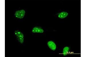Immunofluorescence of monoclonal antibody to POLR1B on HeLa cell.