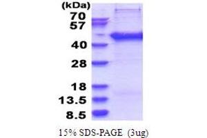 SDS-PAGE (SDS) image for SERTA Domain Containing 2 (SERTAD2) (AA 1-314) protein (His tag) (ABIN6387461) (SERTAD2 Protein (AA 1-314) (His tag))
