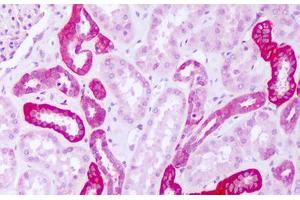 Image no. 1 for anti-Phenylalanyl-tRNA Synthetase, alpha Subunit (FARSA) (AA 276-325) antibody (ABIN6749793) (Phenylalanyl-tRNA Synthetase, alpha Subunit (FARSA) (AA 276-325) antibody)
